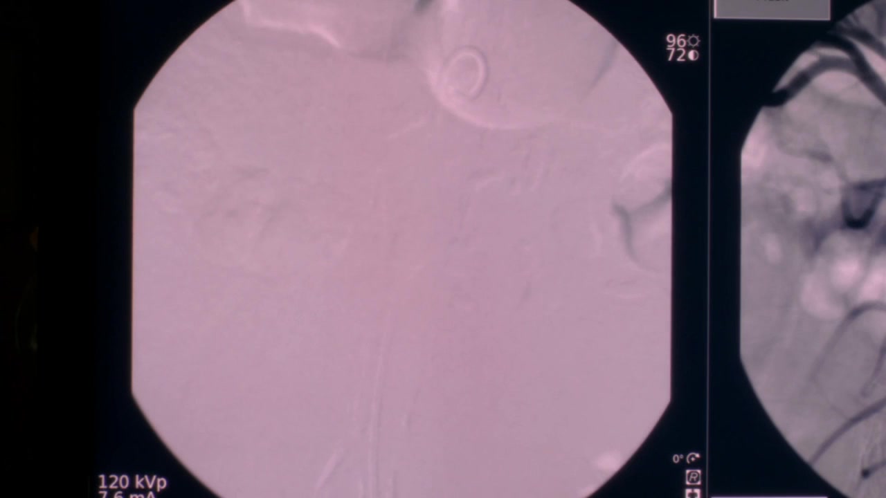 GA1416-00844.jpg