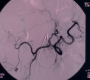 GA1416-00845.jpg