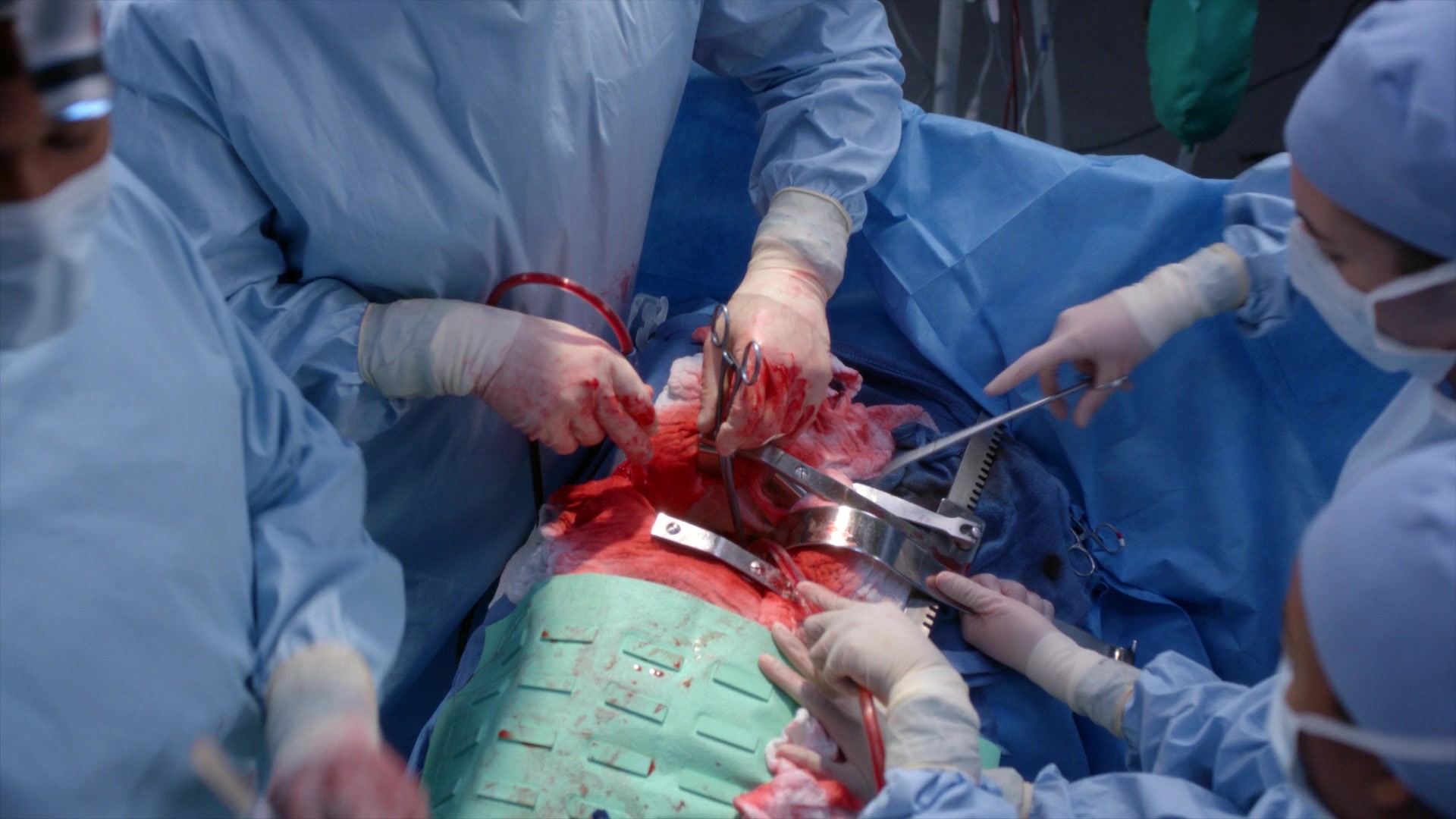 Greys_Anatomy_S19E11_1585.jpg
