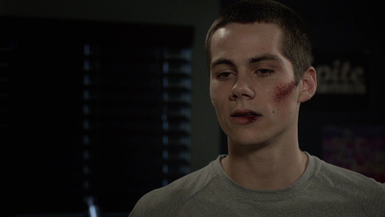 212TeenWolf0460.jpg