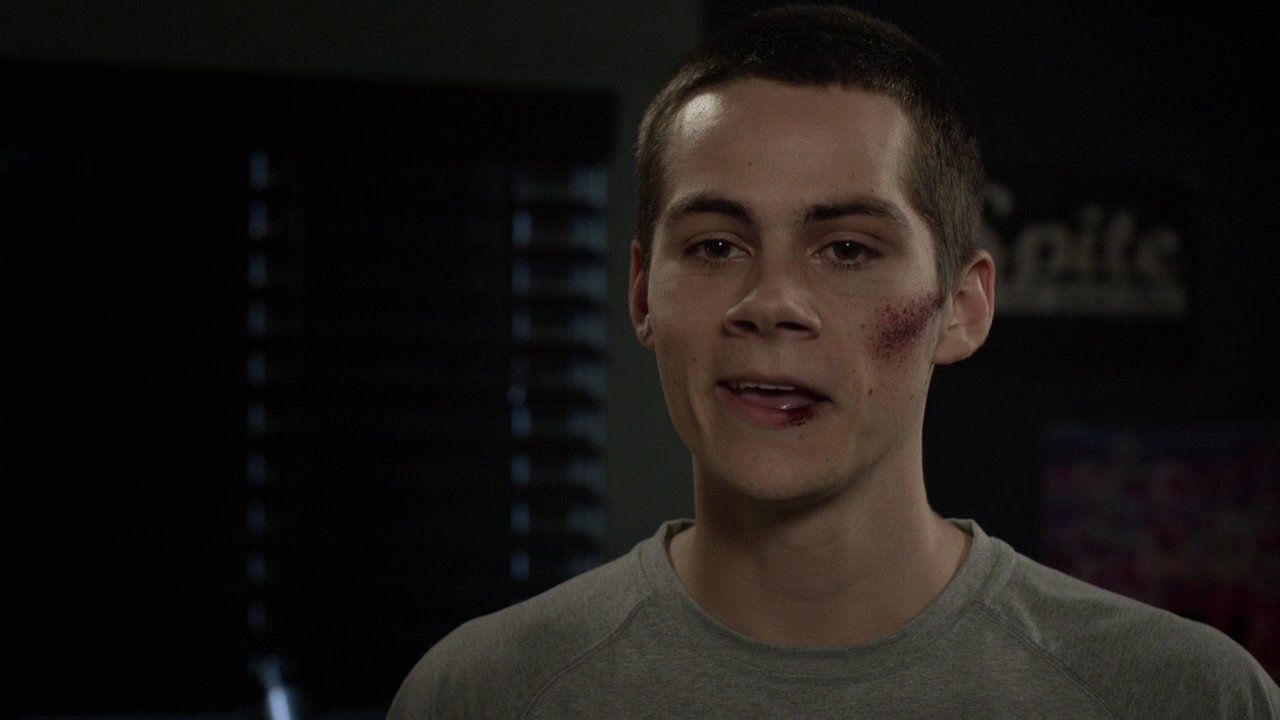 212TeenWolf0470.jpg